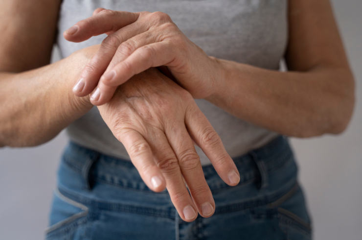 Rheumatoid Arthritis