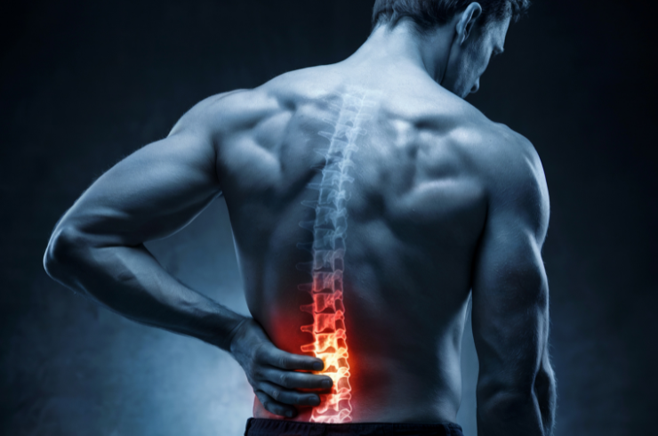 SI Joint Arthropathy